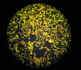 リケッチア感染細胞内のつつが虫病リケッチア抗原がアップルグリーン色に発光しているイメージ