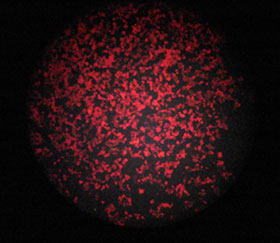 リケッチア感染細胞が赤く染まっているイメージ
