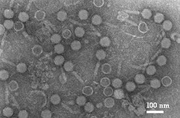 大腸菌に感染するラムダファージの写真