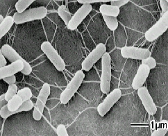 大腸菌（電子顕微鏡写真）