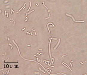 火落菌の顕微鏡写真