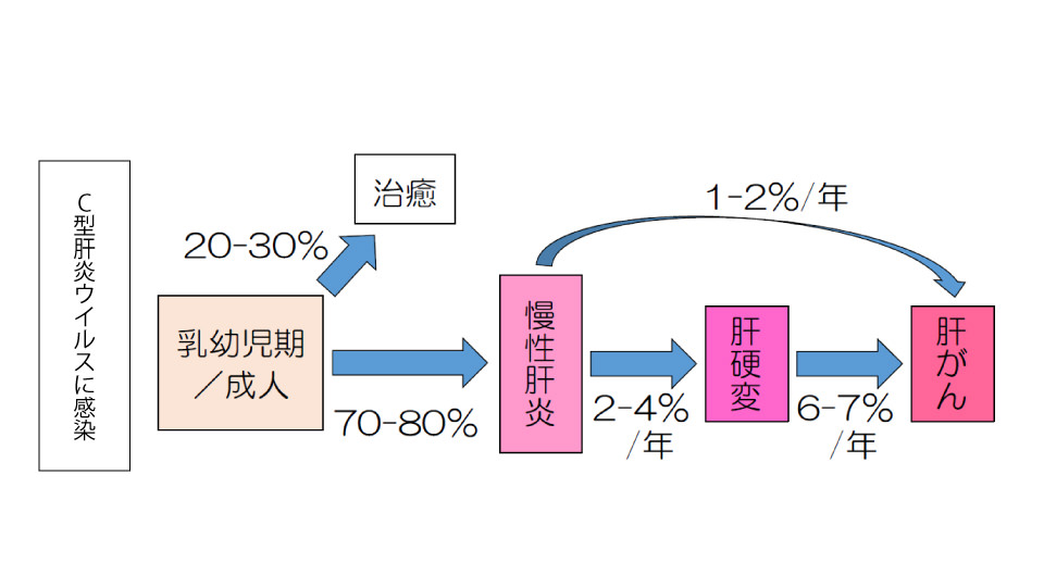 C型肝炎感染後に起こりやすい病気