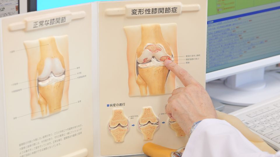 膝を診る目 診断・治療のエッセンス 名医の目のつけどころ 膝の痛み 広がる治療法 県立安芸津病院を紹介 | 徹底解剖！ひろしま