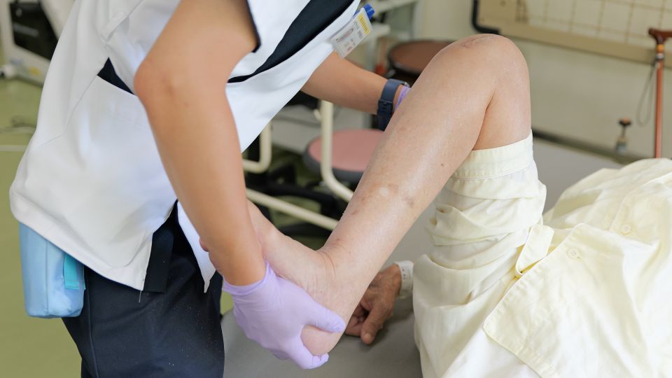 患者さんの足の状態を確認する様子