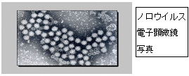 ノロウイルス電子顕微鏡の写真