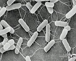 腸管出血性大腸菌の写真
