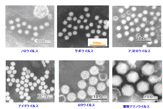 感染性胃腸炎の原因ウイルス