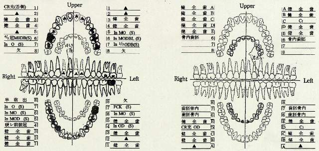 上記歯形のデンタルチャートの画像