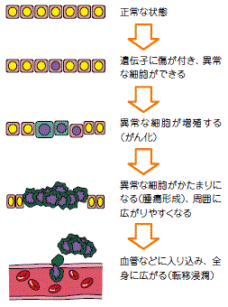 がんの発生と進行の仕組み