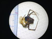 クロゴケグモ腹側